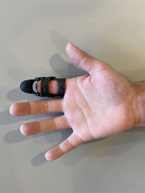 Funktionelle Fingerprothesen Von Naked Prosthetics