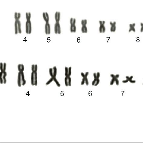 Karyotypes Of Rhinella Jimi Based On Giemsa Staining A Male Metaphase Download Scientific