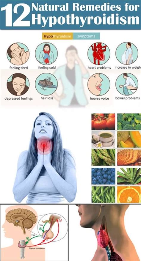 12 Simple Remedies For Hypothyroidism Health And Wellbeing