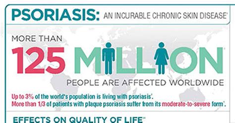 Facts About Psoriasis New Life Outlook Psoriasis