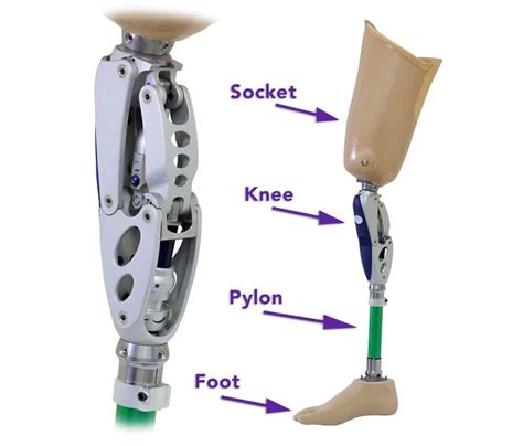 Lower Limb Prosthesis 101 Knowledge Is Power Sheltering Arms