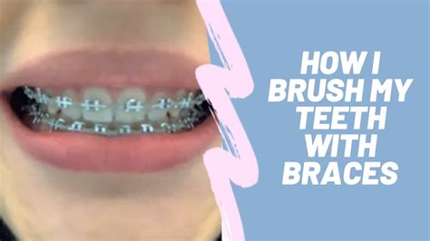 Here's a little refresher for on how to brush with proper technique: How I Brush My Teeth With Braces!! - YouTube
