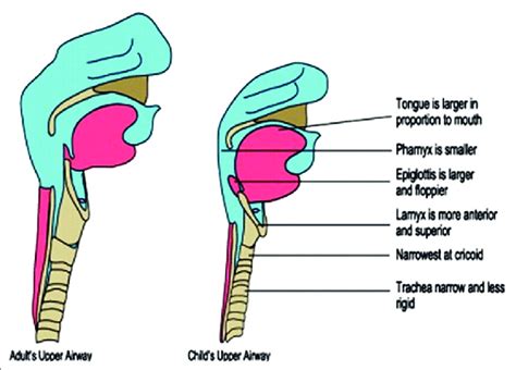 Cross Section Of Both The Adult And Paediatric Larynx Download