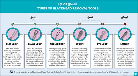 Blackhead Removal Tools And Treatments The Ultimate Guide Skin Care Ox