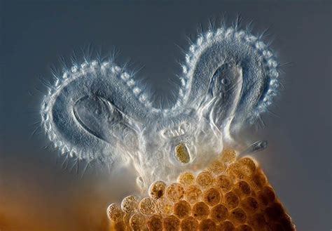 20 Impresionantes Fotografías Microscópicas Ganadoras De Este Original