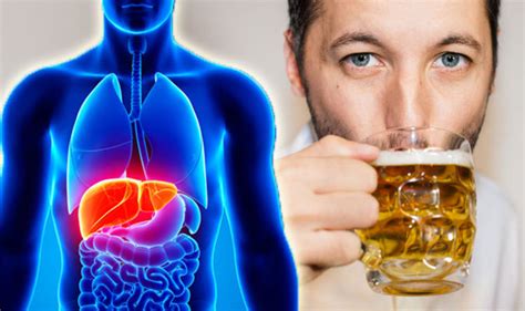 Alcohol Related Liver Disease Maintaining Liver Health Long Term Approach Uk