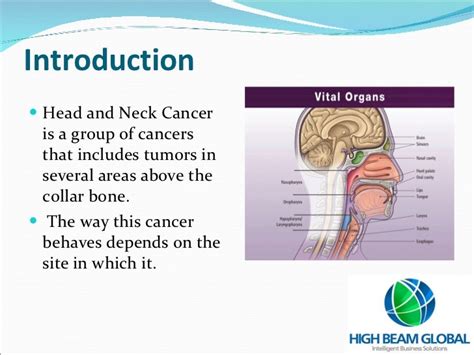 High Beam Global Head And Neck Cancer Ppt