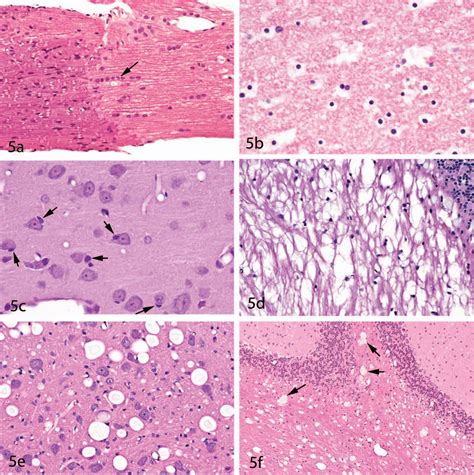 Histology Of Nervous System Pdf Mapasgmaes