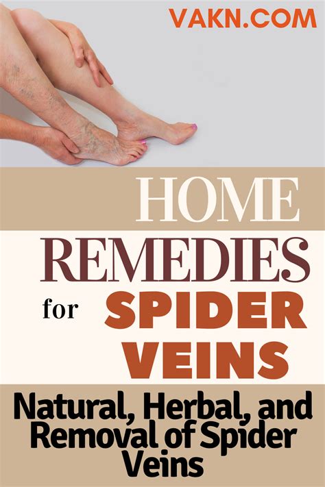The 1 Home Remedies For Spider Veins Natural Herbal Removal Of Spider Veins Home Remedies