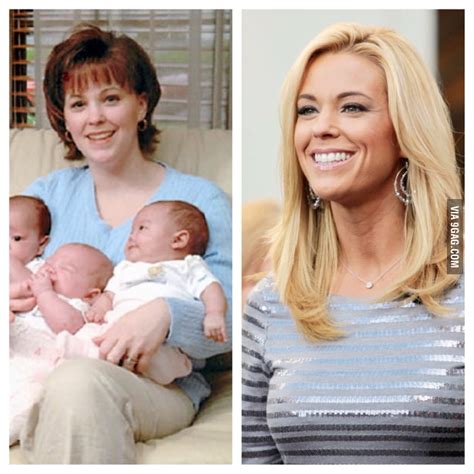 Kate Gosselin From Jon Kate Plus Before And After Money Started
