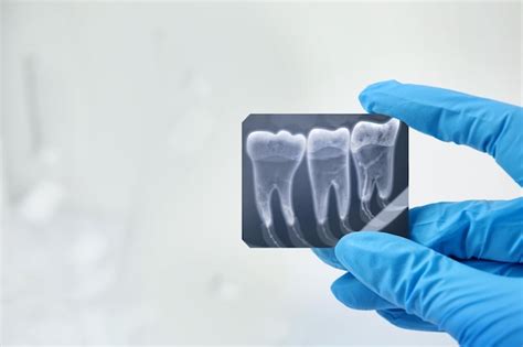 Premium Photo Doctor Holding Xray Picture Of Teeth Indoor
