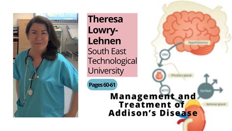 Management And Treatment Of Addisons Disease Hospital Professional News