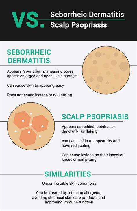 I am going to show you how is scalp psoriasis different from dandruff? Dry Scalp Vs. Dandruff: What's The Difference? #haircare # ...