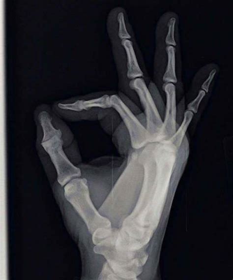X Rays That Will Make You Very Uncomfortable 22 Pics Izispicy Com