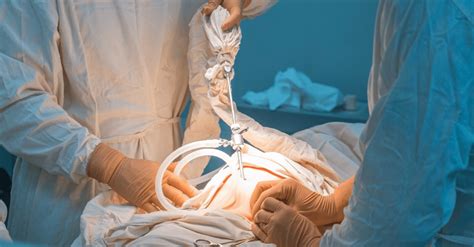 Hiatal Hernia Surgery Questions Olde Del Mar Surgical