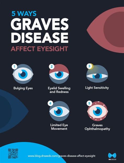 5 Ways Graves Disease Affect Your Eyesight Infographic Dr Seeds