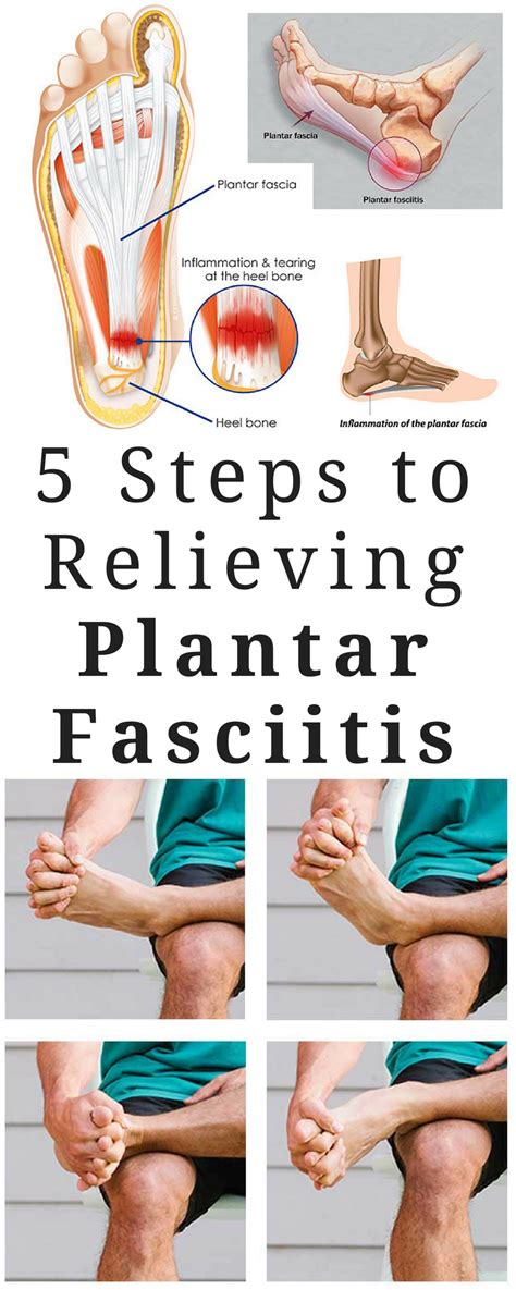 Pin On Plantar Fasciitis Treatment Exercises Symptoms And Causes