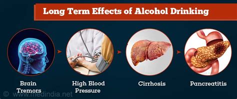 Alcohol Use Disorder Alcoholism
