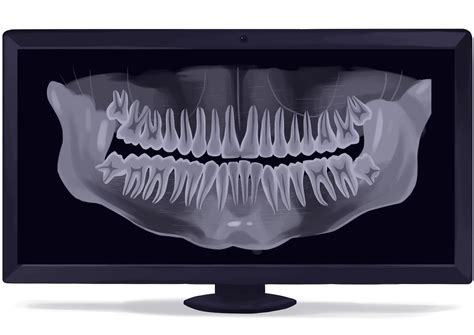 Panoramic Dental X Ray Digital Technical Picture Picture B Flickr