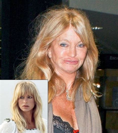 Goldie jeanne hawn is an american actress, producer, dancer, and singer. Goldie Hawn - Plastic Surgery | Bad plastic surgeries ...