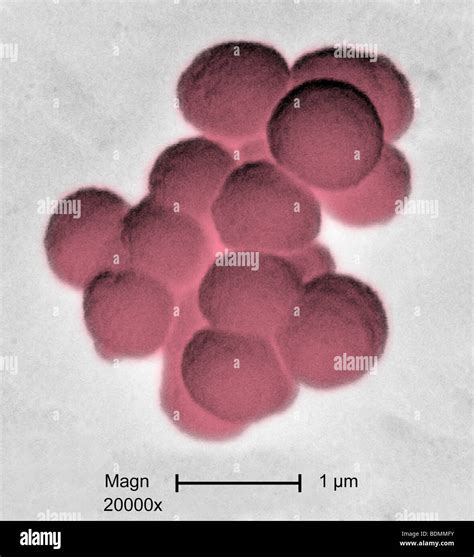 Análisis Micrografía De Electrones Sem De Los Racimos De Bacterias