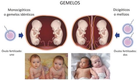 diferentes tipos de gemelos embarazos múltiples etapas del embarazo y parto menudo embarazo