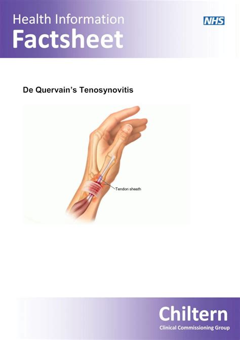 Pdf De Quervains Tenosynovitis Careuk What Is De Quervain S
