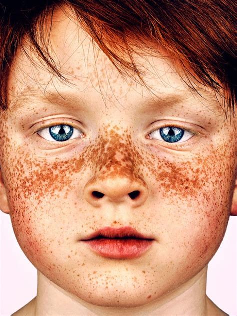 These Stunning Portraits Show The True Beauty Of Freckles
