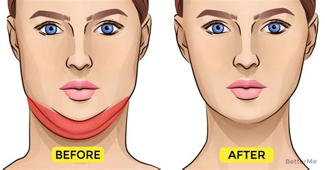 The Neck And Chin Are Strategic Zones Because They Are Clear