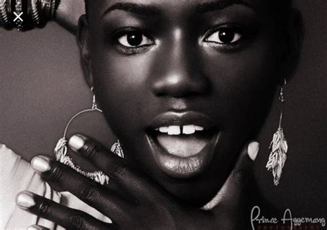 The bands are meant for patients with little misalignment and only a small gap in the the down side to tooth gap bands is they often cause gaps in other teeth and your other teeth must be completely straight for them to work properly. Why do a lot of African women have gap teeth? - Quora