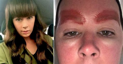 Woman Left With Horrific Scars After Eyebrow Tattoos Became Infected