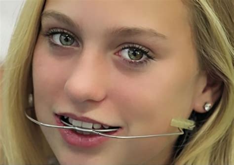 Pin By Larry Greenstein On Girls With Dental Braces And Headgear Teeth Braces Dental Braces