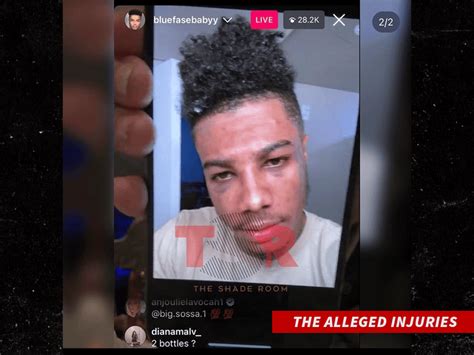 Chrisean Rock Appears To Admit To Giving Blueface Two Black Eyes