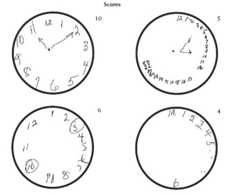 Moca scoring nuances with clock draw / the value of clock drawing in identifying executive cognitive dysfunction in people with a clock drawing test scoring system with python. Clock Drawing at PaintingValley.com | Explore collection ...