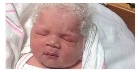 „Нещо необяснимо “ Ето как изглежда и живее днес уникалното дете родено с бяла коса