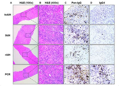 Representative Histopathologic And Immunohistochemical Findings Of Download Scientific