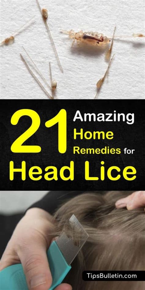 21 Natural Remedies For Head Lice