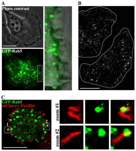Edge detection could refer to either of the above, or to many modern edge detection algorithms that are much more sophisticated than either of the above. Rab5 localization at the leading edge and focal adhesions ...