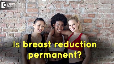 Are Breast Reductions Permanent Dr Srikanth V Youtube