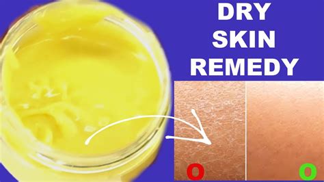 Get Rid Of Dry Flaky Skin Effective Remedy For Dry Skin Get Soft