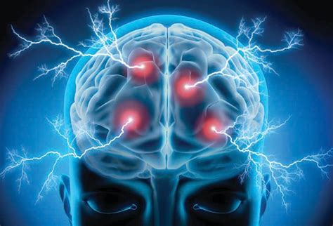 Using Transcranial Low Level Laser Therapy For The Management Of Mild