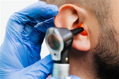 Acupuncture For Tinnitus Ringing In Ears The Best Acupuncture Near