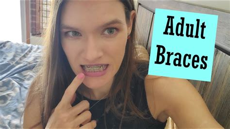 Getting Braces As An Adult Youtube