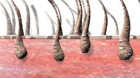 However, becoming a leader in your local laser hair removal market requires a stellar marketing strategy to help establish your spa as a trusted hair removal expert. Ideal Image Laser Hair Removal Treatment Demonstration ...
