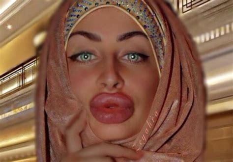 Meet The Woman With The Largest Lips Photos How