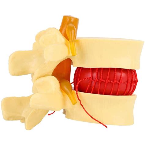Buy Anatomical Model Anatomical Human Spine Lumbar Vertebrae