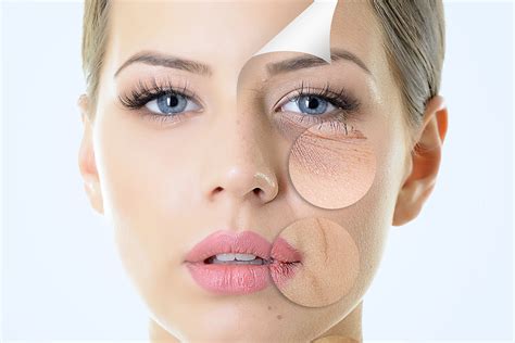 Fine Lines And Wrinkle Reduction Apex Medical Spa