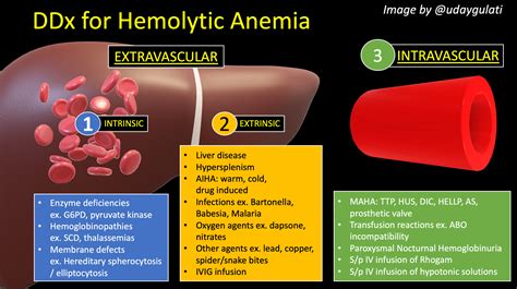 How Do You Workup Hemolytic Anemia Inspira Meded
