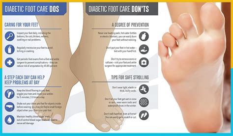 Signs And Complications Of Diabetes Foot Problems For Diabetic Patients Diabetes Foot Care