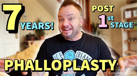 Life After Phalloplasty Is Incredible And Normal At The Same Time 7 Years Post Lower Surgery